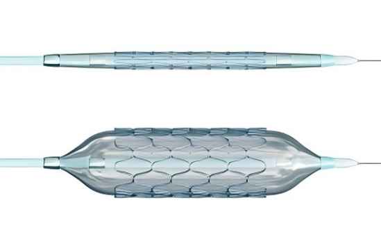 ¿Cuál es la diferencia entre un Stent y un catéter de globo?