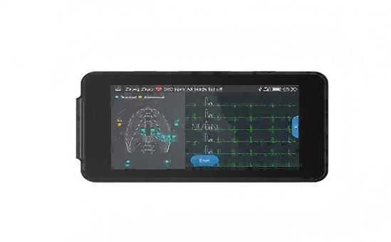 Postępy nowoczesnej maszyny EKG w szpitalnych systemach monitorowania telemetrii
