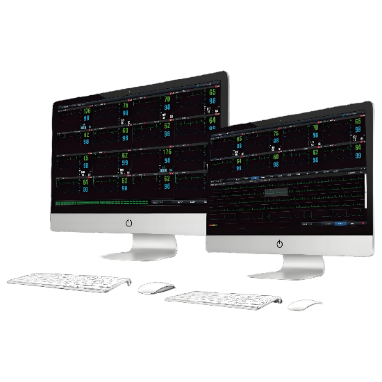 Platforma AI-ECG