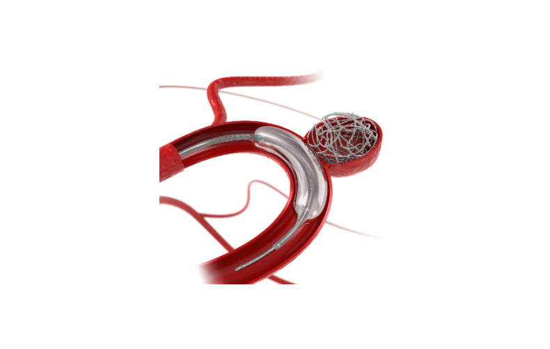 Embolization