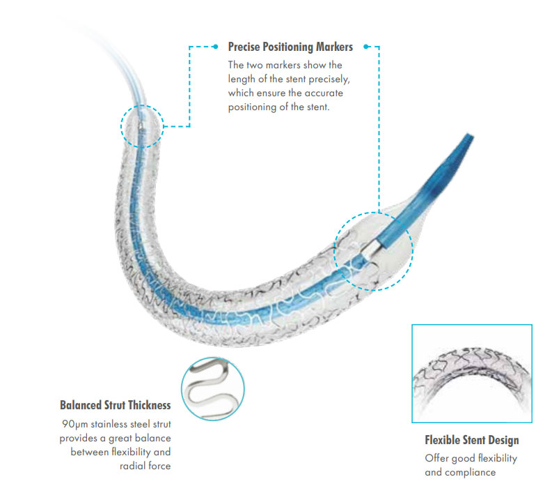 Stainless Steel Coronary Stent