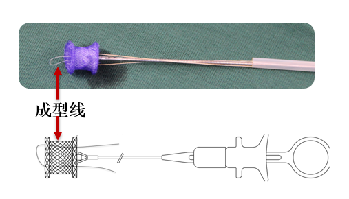 World's First Fully Absorbable Occluder Launched