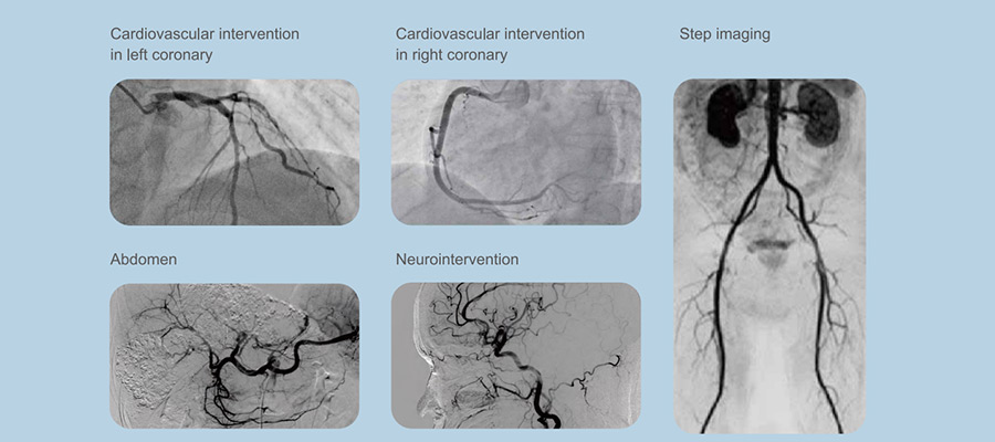 Vicor-CVロビンC/F Digital Subtraction Angiography System